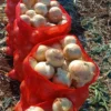 YELLOW ONIONS 🇹🇷